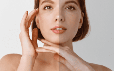 7 WAYS TO FIX AN UNEVEN SKIN TONE