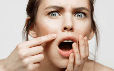 WHAT SHOULD YOU DO ABOUT DARK SPOTS